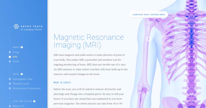 7 Tests for Gaucher Disease Management